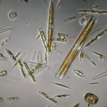 Microscopic observation of diatoms